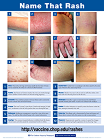Picture of Rash Poster:  Set of 10